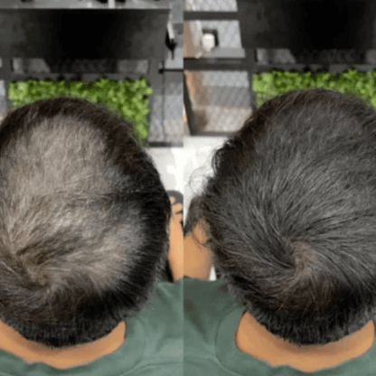 Cubre canas y calvicie al instante — Funciona para hombres y mujeres.