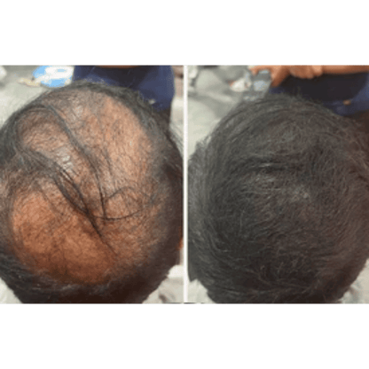 Cubre canas y calvicie al instante — Funciona para hombres y mujeres.