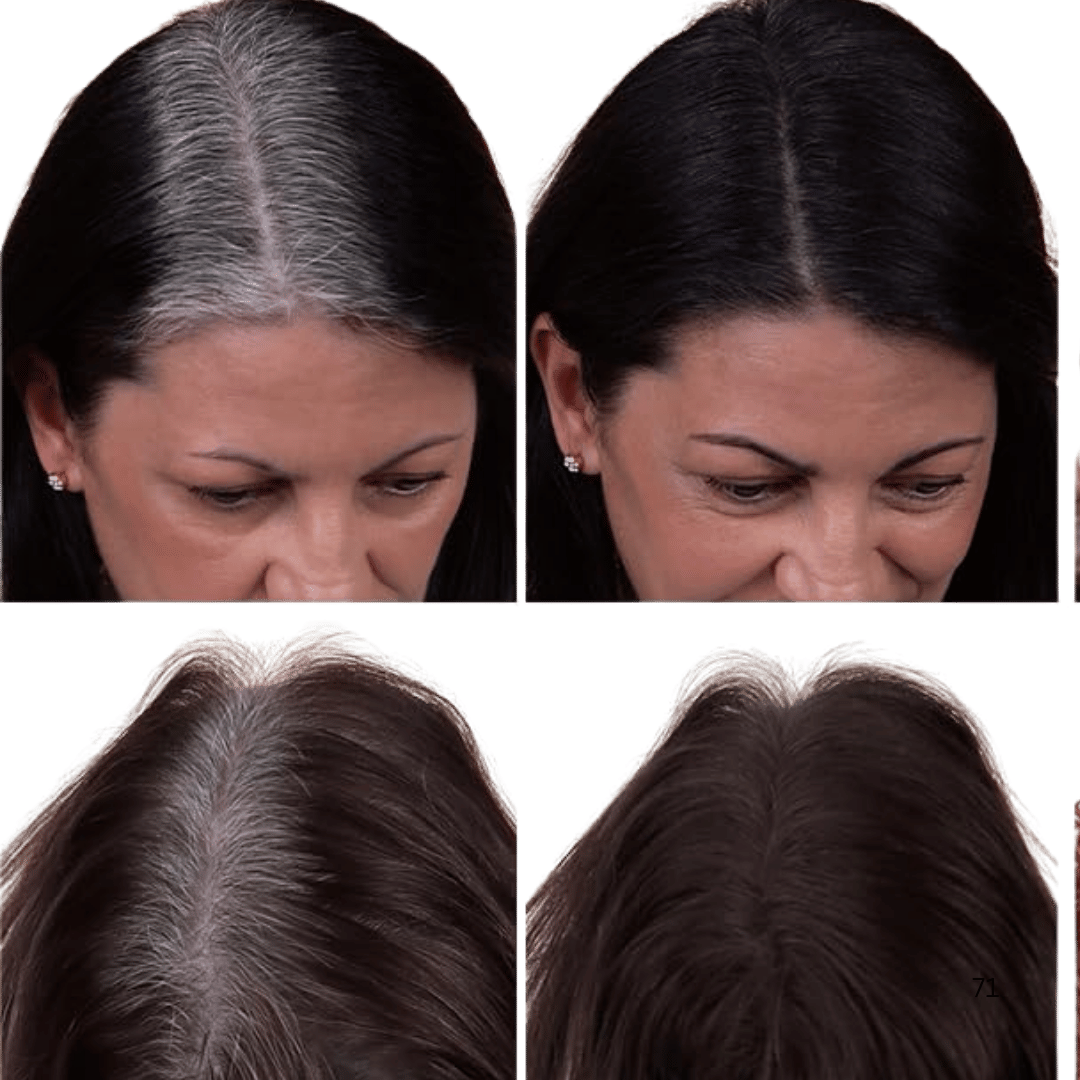 Cubre canas y calvicie al instante — Funciona para hombres y mujeres.